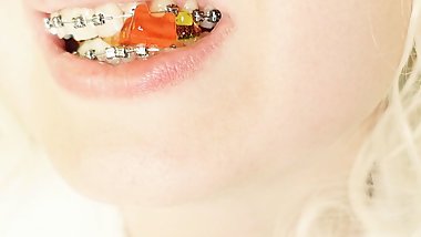 BRACES fetish: ASMR video of eating MUKBANG...