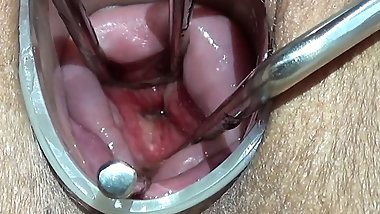 Maya Simons OPENING HER CERVIX (EXTREME)
